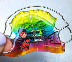Orthodontic appliance